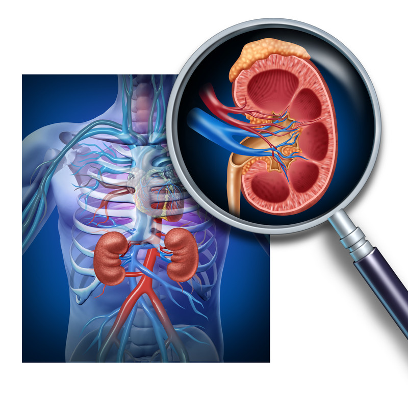 Image of a human interior with a focus on the kidney | Comfort Keepers Edmonton | BLOG POST | Symptoms of Kidney Disease