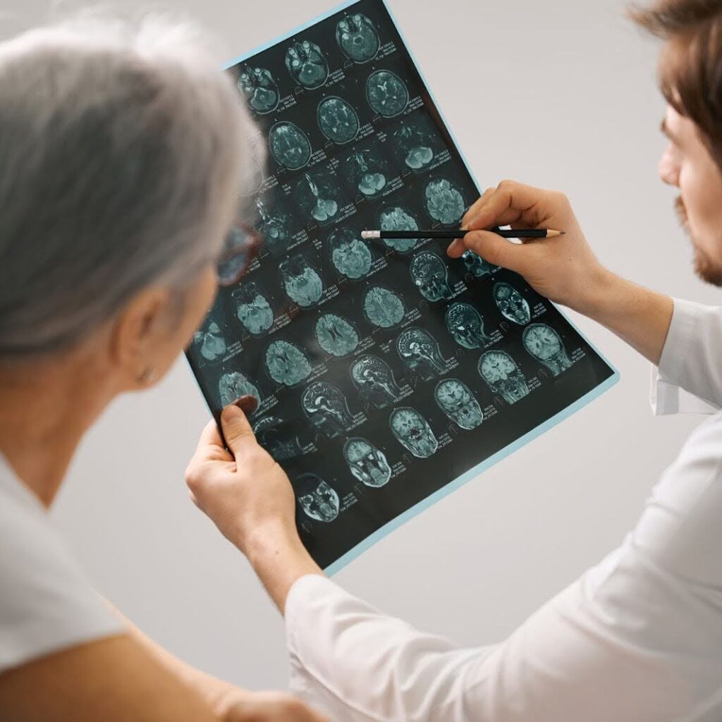 Doctor holding brain MRI scan explaining dementia and sundowning to family caregivers