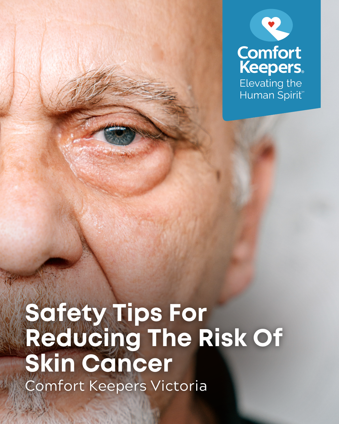 A closeup of a senior male's face | Safety Tips For Reducing The Risk Of Skin Cancer | Comfort Keepers Victoria | BLOG POST