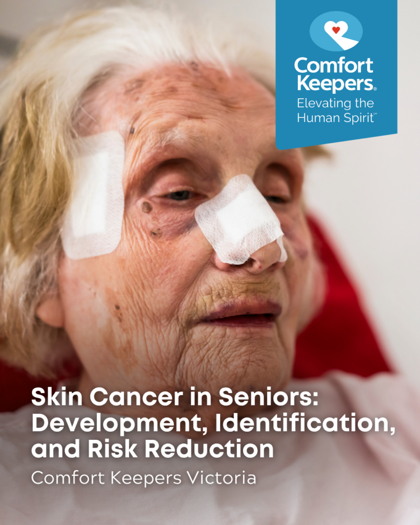 Senior woman with bandages on her face after skin cancer has been removed | Comfort Keepers Victoria | Skin Cancer in Seniors: Development, Identification, and Risk Reduction | BLOG POST
